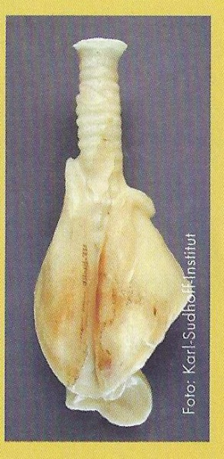 Weihgabe des Volksglaubens: Das Lungenmotiv aus mit Wachs überzogenem Gips. Foto: Karl-Sudhoff-Institut
